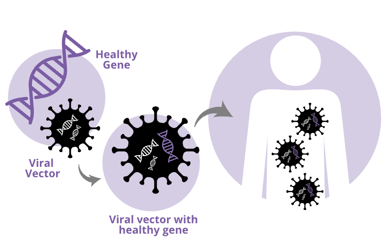 AAVgenetherapy